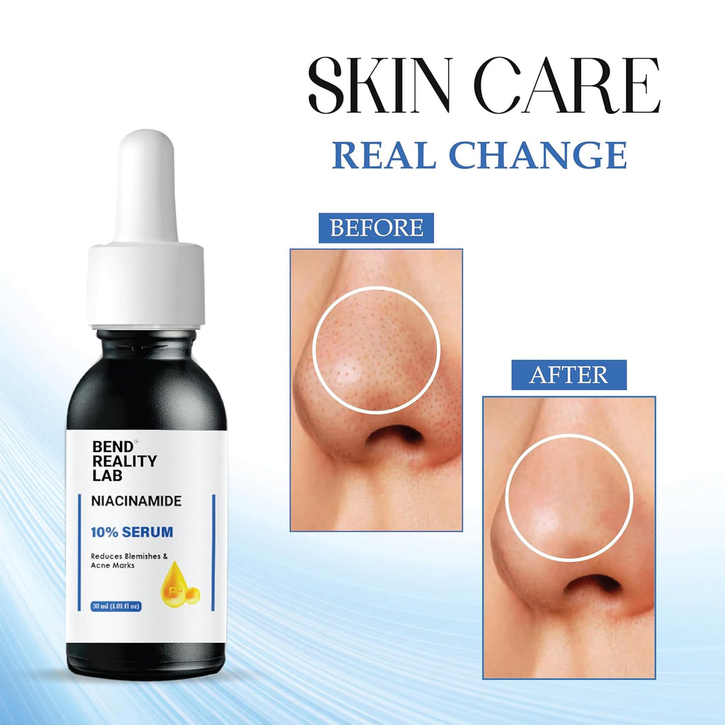 Bend Reality Lab Niacinamide 10% Serum for Dark Spots, Blemishes & Acne Marks, Minimises Pores, Brightening, 30ml