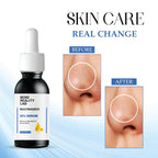 Bend Reality Lab Niacinamide 10% Serum for Dark Spots, Blemishes & Acne Marks, Minimises Pores, Brightening, 30ml