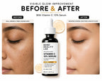 Bend Reality Lab Vitamin C 10% Face Serum | Ethyl Ascorbic Acid + Hyaluronic Acid | Brightening & Dark Spot Serum – 30ml