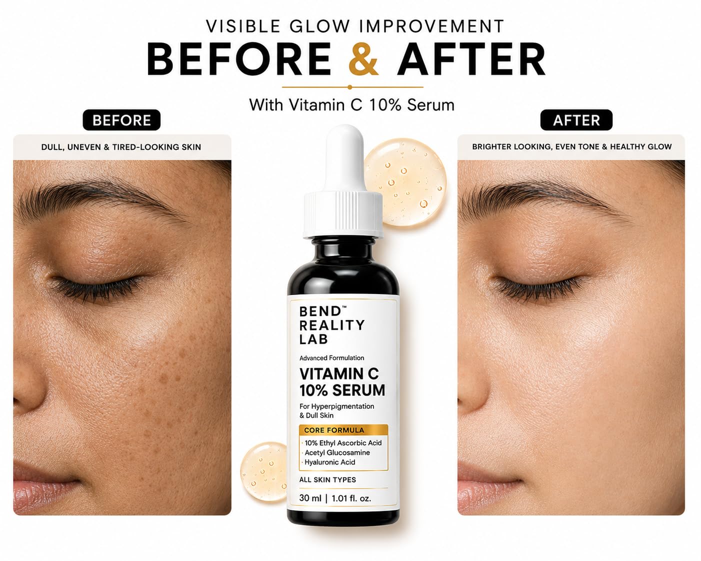 Bend Reality Lab Vitamin C 10% Serum – Ethyl Ascorbic Acid + Hyaluronic Acid + Acetyl Glucosamine – Brightening Serum for Hyperpigmentation, Dark Spots & Dull Skin – All Skin Types – 30ml
