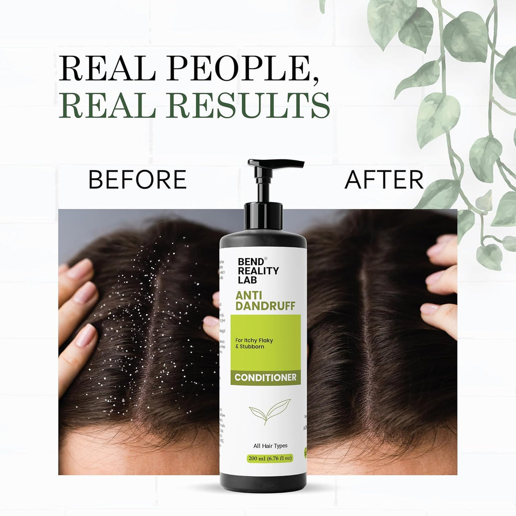 Bend Reality Lab Anti Dandruff Conditioner, for Itchy Flaky & Stubborn Dandruff, All Hair Types, 200 ml