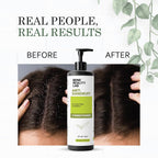 Bend Reality Lab Anti Dandruff Conditioner, for Itchy Flaky & Stubborn Dandruff, All Hair Types, 200 ml