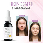 Bend Reality Lab Skin Brightening Face Serum for Dark Spots and Pigmentation, 30 ml, Unscented, Liquid