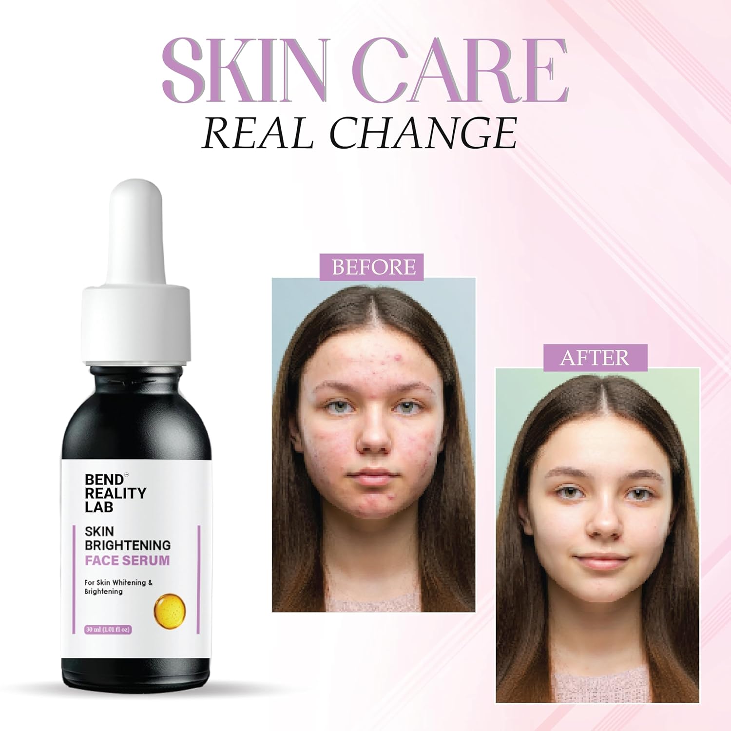 Bend Reality Lab Skin Brightening Face Serum for Dark Spots and Pigmentation, 30 ml, Unscented, Liquid