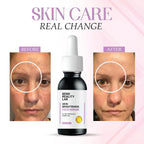 Bend Reality Lab Skin Brightening Face Serum for Dark Spots and Pigmentation, 30 ml, Unscented, Liquid