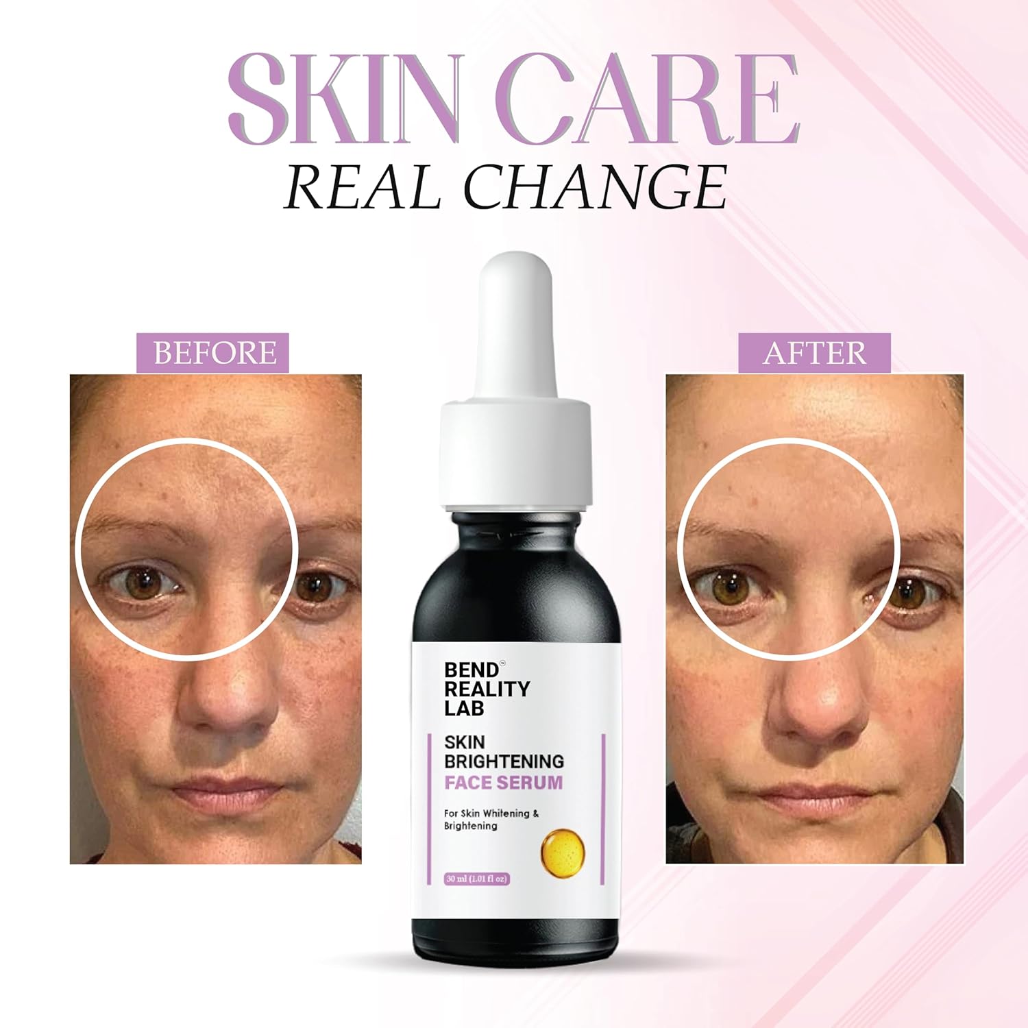 Bend Reality Lab Skin Brightening Face Serum for Dark Spots and Pigmentation, 30 ml, Unscented, Liquid