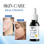 Bend Reality Lab Niacinamide 10% Serum for Dark Spots, Blemishes & Acne Marks, Minimises Pores, Brightening, 30ml