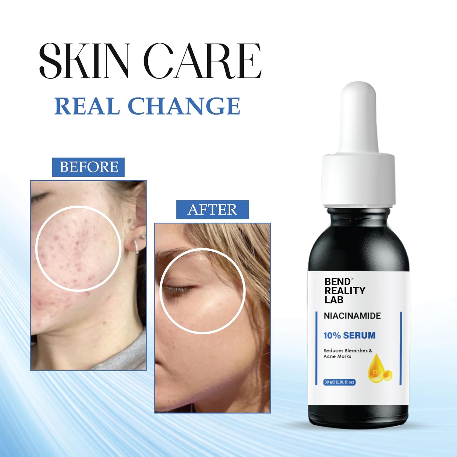 Bend Reality Lab Niacinamide 10% Serum for Dark Spots, Blemishes & Acne Marks, Minimises Pores, Brightening, 30ml