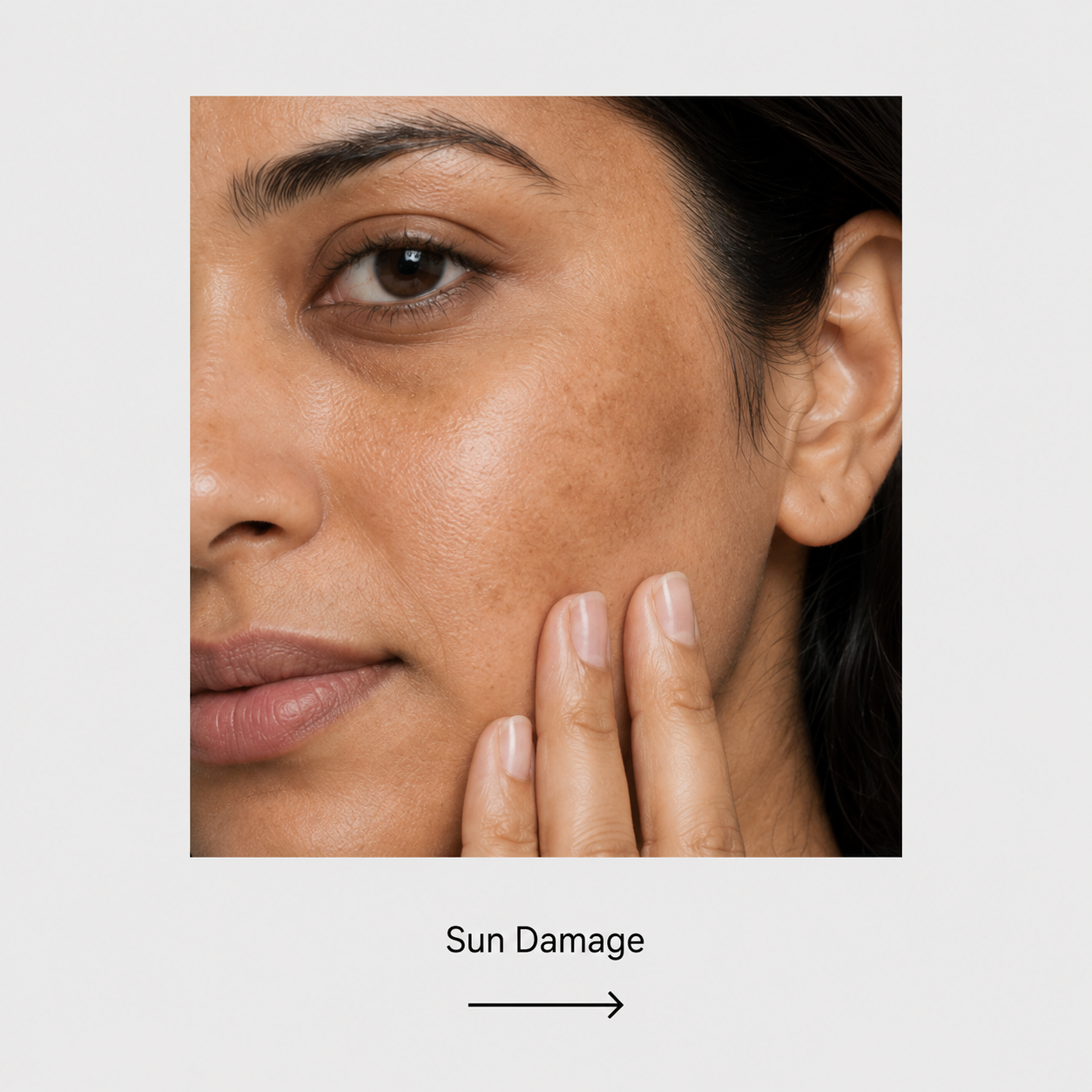 Sun Damage